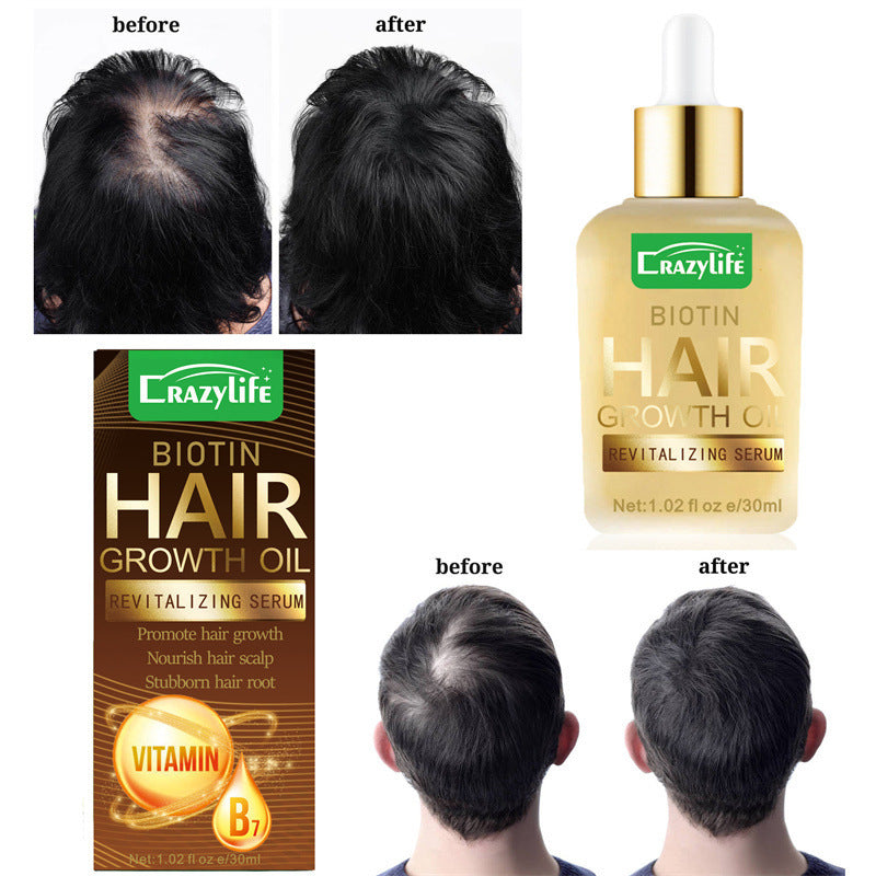 Óleo Essencial para Cuidados com os Cabelos 30ml Suave e Refrescante