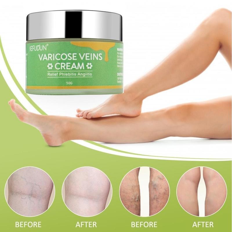 Creme para veias, manchas vermelhas, reparação de hematomas nas pernas, alívio de protuberâncias, loção para cuidados com a pele, creme para varizes